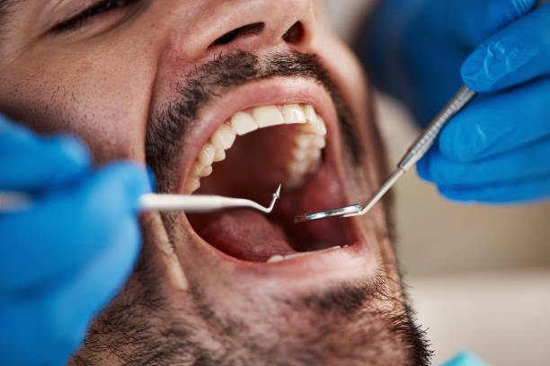 Best Oral Cancer Screening  in Oakwood, OH
